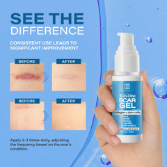 Bruizex Aplicación masaje cicatriz para absorción rápida y suave.