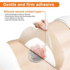 CARBOU apósito en empaque estéril listo para uso seguro