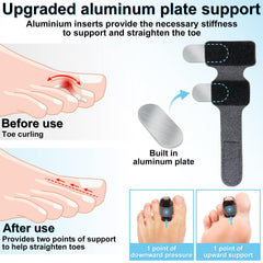 DLMDLM corrector dentro de zapato mejora confort al caminar