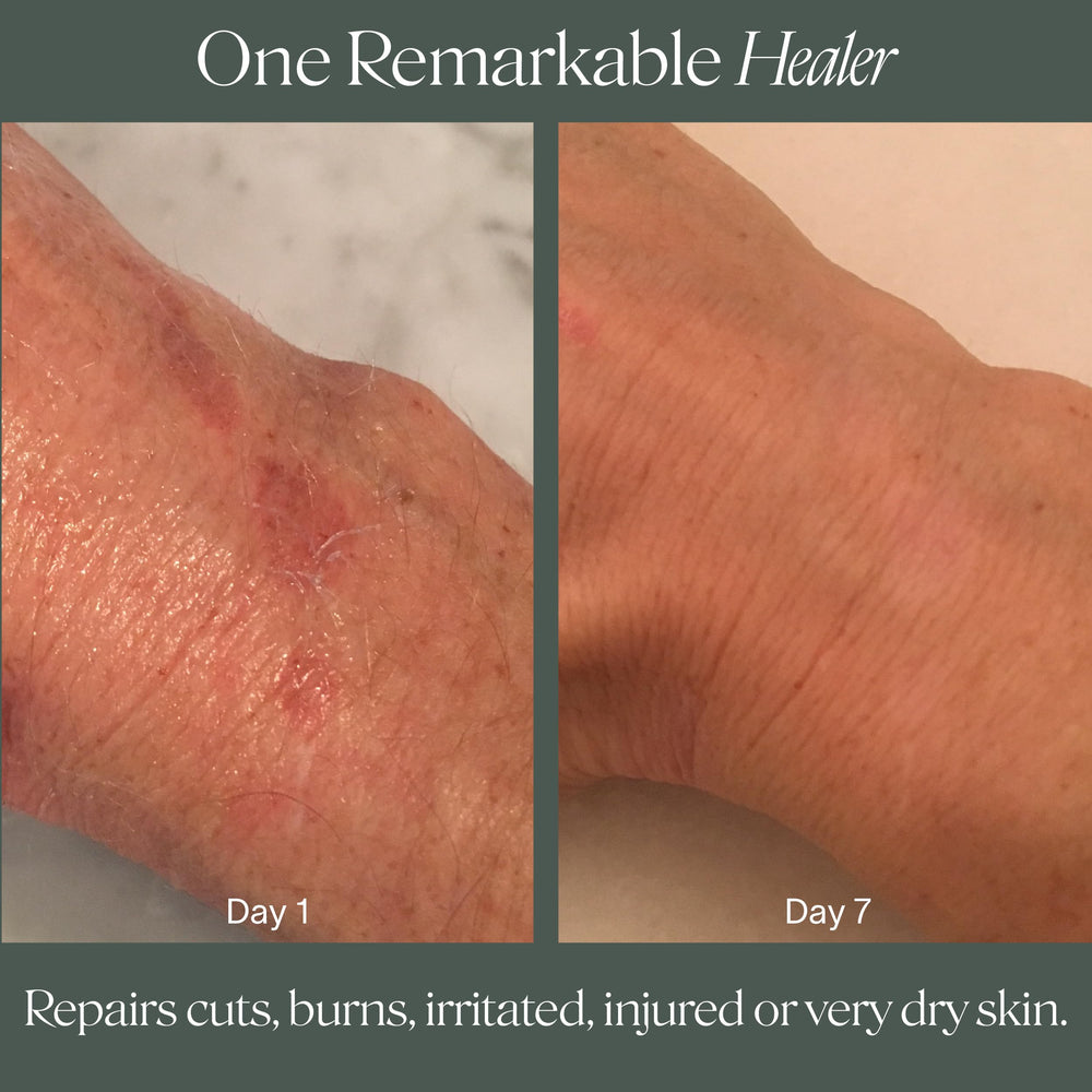 Doctor Rogers aplicación en labios para alivio y protección inmediata