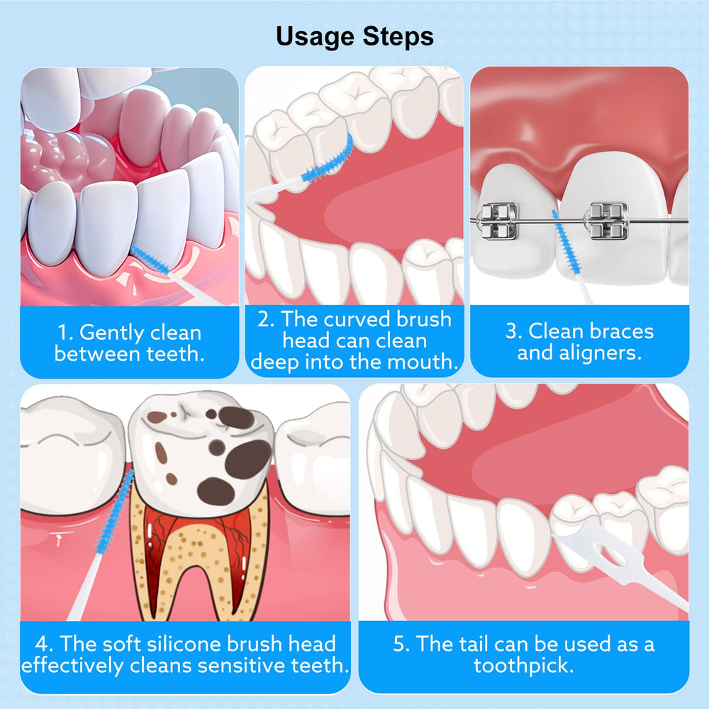 lanjue uso del cepillo entre brackets, mejora limpieza en aparatos