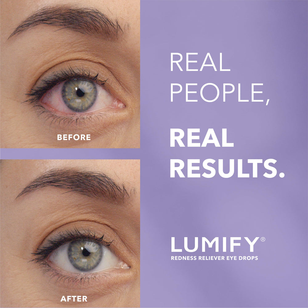 LUMIFY caja abierta con detalle de instrucciones y sello FDA visible