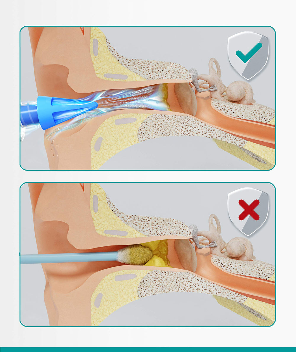 Medi Grade kit desmontado sobre mesa mostrando piezas fáciles de limpiar