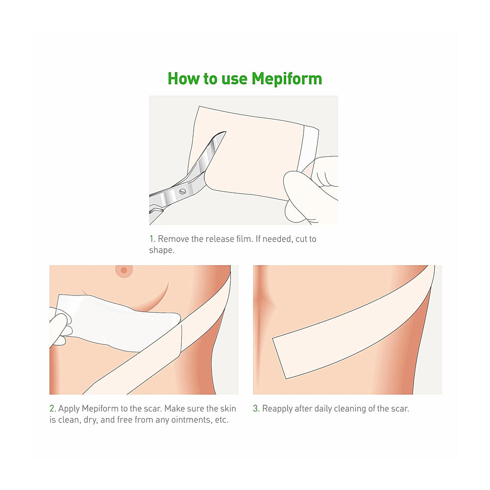 Mepiform sobre brazo en uso, sujeción discreta y protección de la cicatriz