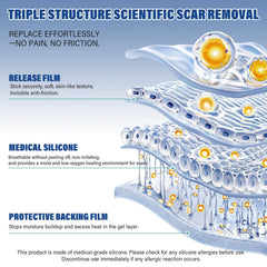Mitreal tira aplicada sobre cicatriz de cesárea, ayuda a suavizar y proteger la piel