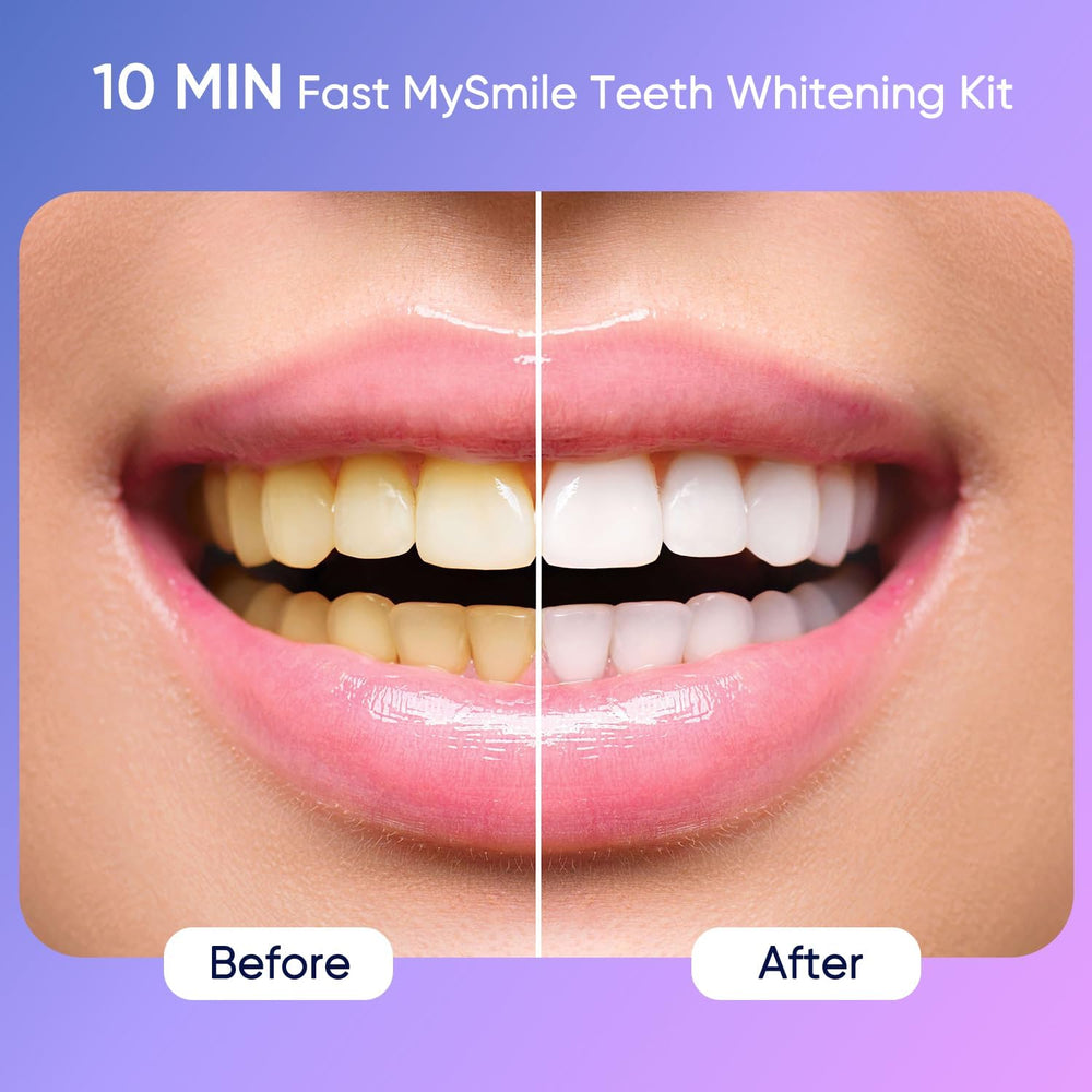 MySmile gel blanqueador textura y color que indica liberación sostenida