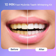 MySmile gel blanqueador textura y color que indica liberación sostenida