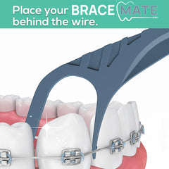 o1brand cepillo de precisión limpiando alrededor de brackets eficaz