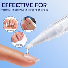PHARMBANNER tratamiento en uñas de pies mostrando uso cómodo y controlado