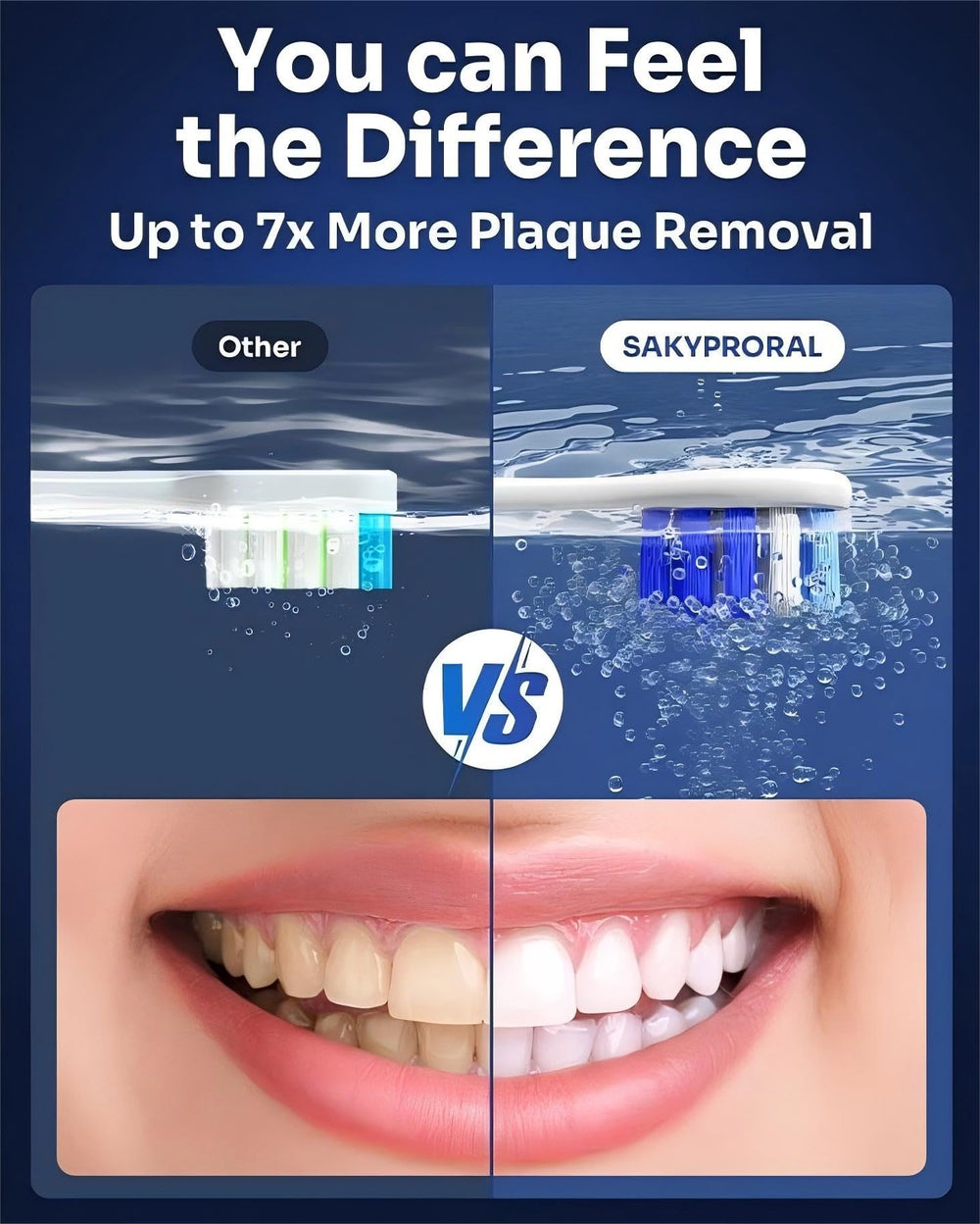 SAKYPRORAL primer plano del cabezal suave del G5S, limpieza delicada
