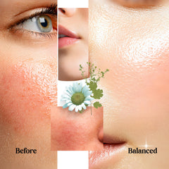 SC Sapphire Blue Tansy Chamomile Hyaluronic Acid essence label highlighting calming hydration