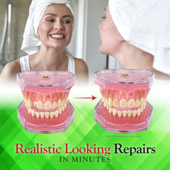 SmileFix herramientas incluidas listadas para un acabado profesional