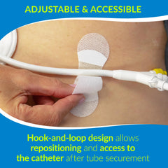 TIDI dispositivo fijando catéter en brazo, sujeción segura en uso