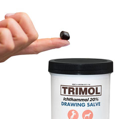 Comparación de tamaño TRIMOL Ichthammol 14 oz junto a objetos de uso diario