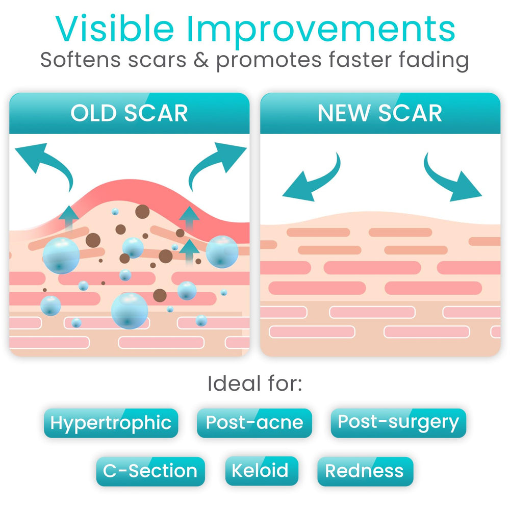 Vive Care aplicación en abdomen para cicatrices de cesárea