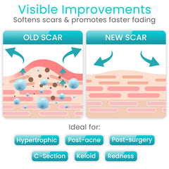 Vive Care aplicación en abdomen para cicatrices de cesárea