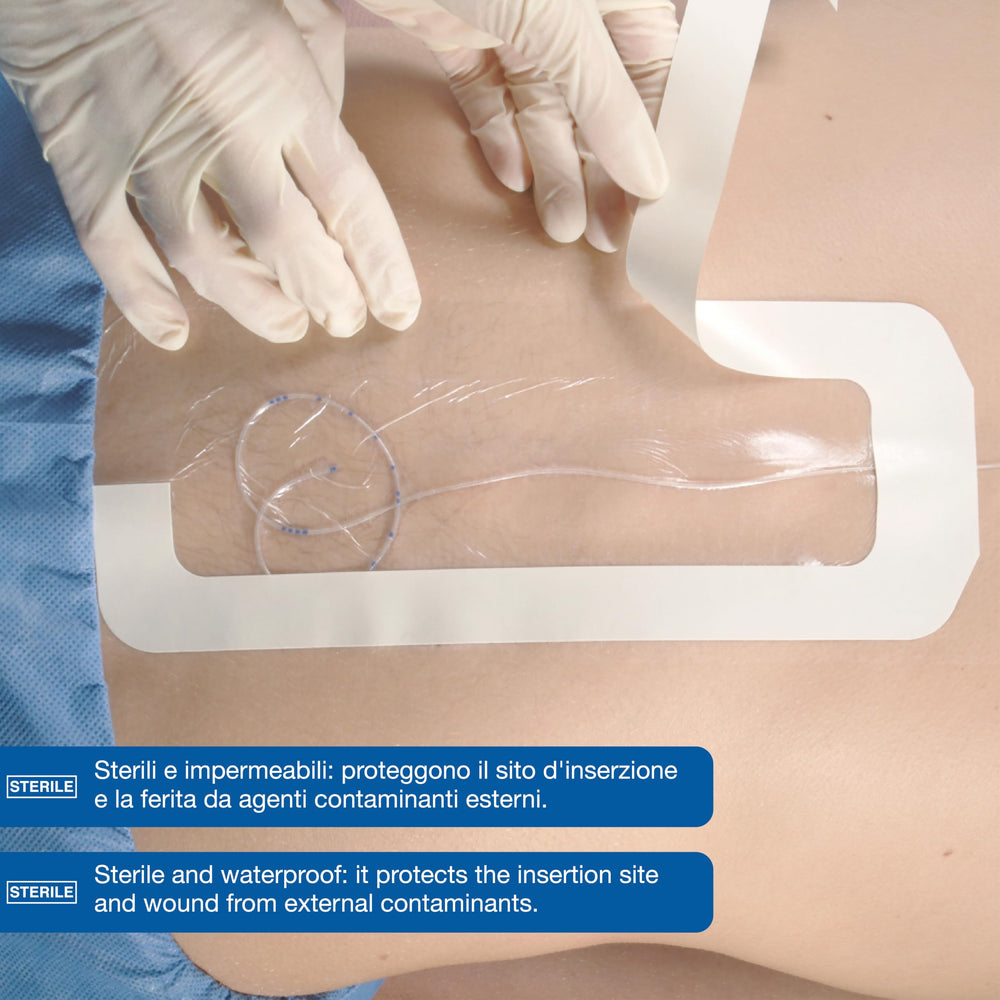 3M Tegaderm detalle del marco facilitando colocación precisa, reduce adhesión a guantes