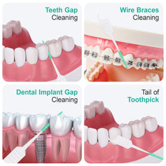ACSKD floss pick en uso limpiando alrededor de brackets con precisión