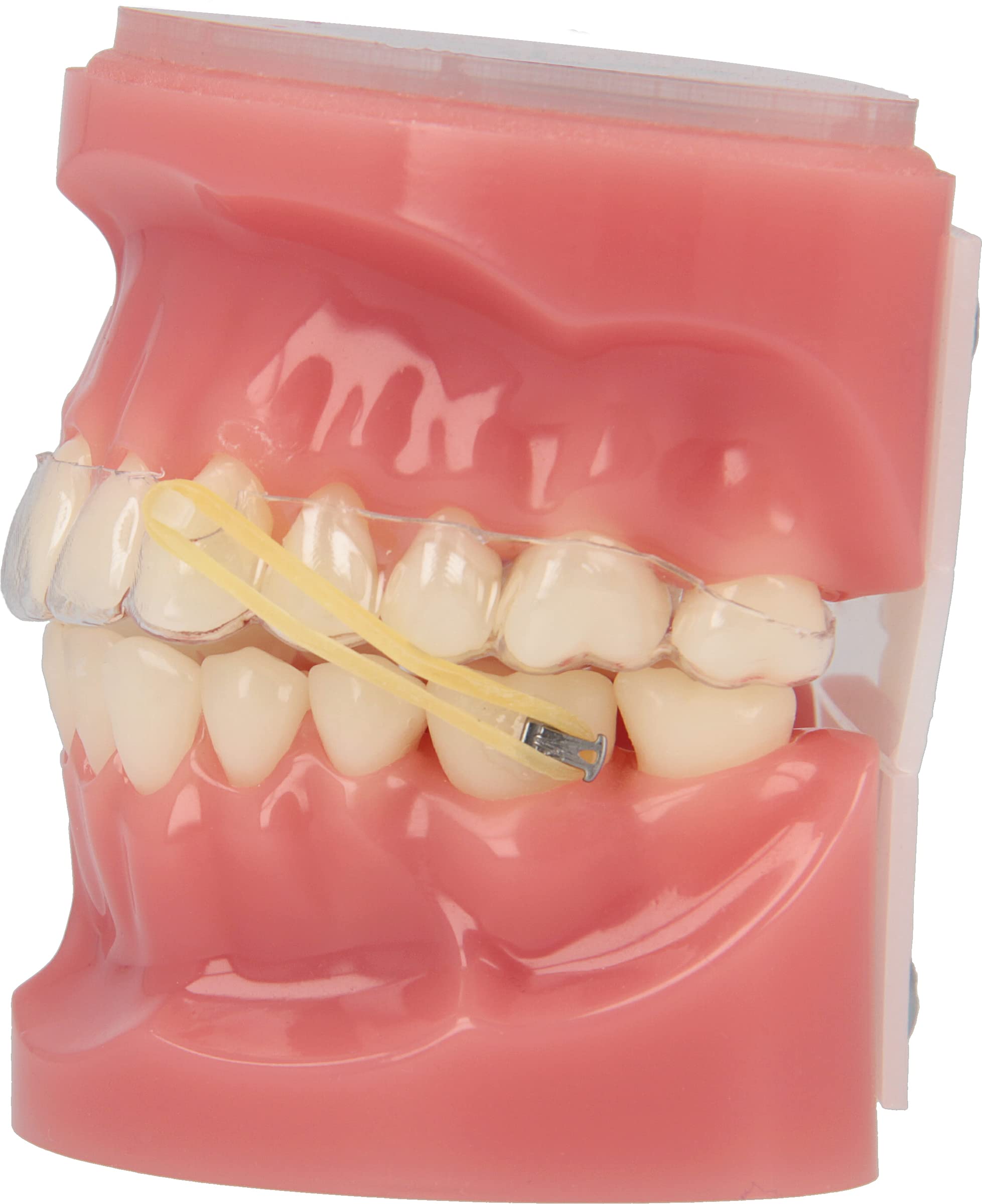 American Orthodontics entorno clínico con profesional sujetando las elastics antes de colocarlas