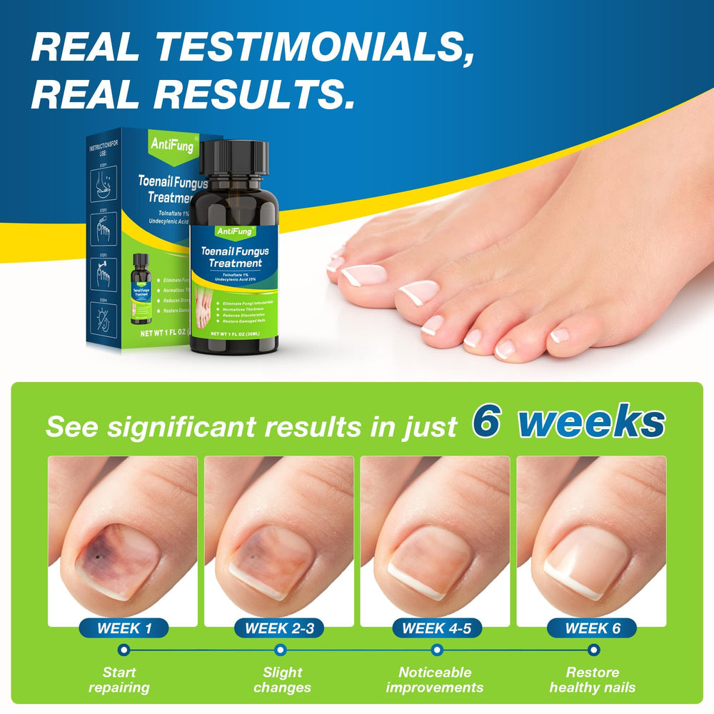 AntiFung detalle de etiqueta mostrando ingredientes y concentración clara