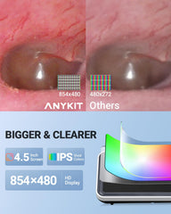 Anykit comparado en mano, muestra tamaño portátil y manejo sencillo