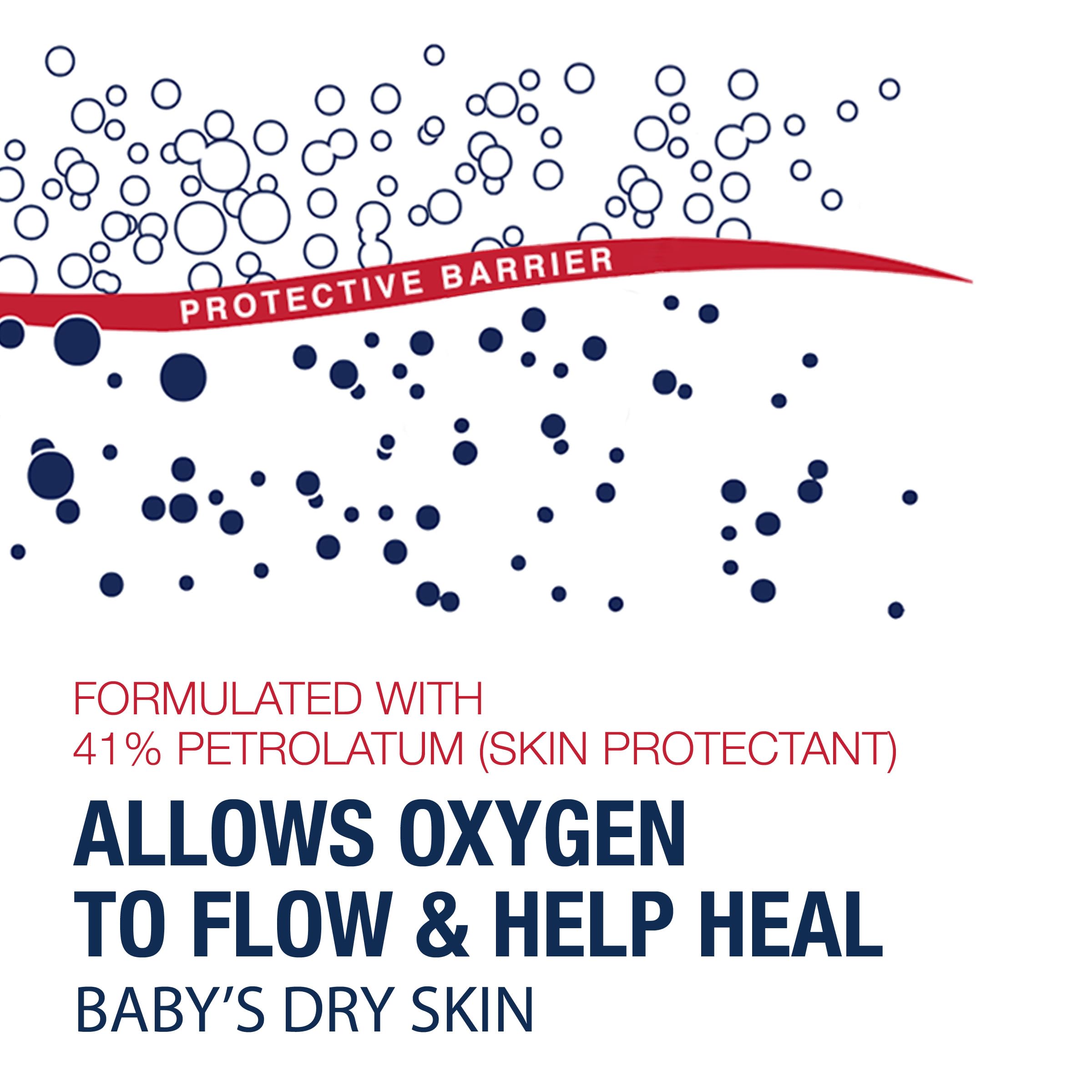 Comparación de tamaño de Aquaphor 14 oz en mano para valorar cantidad útil