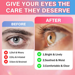 AuraraNeNourish persona frente al ordenador, apoyo nutricional para fatiga ocular