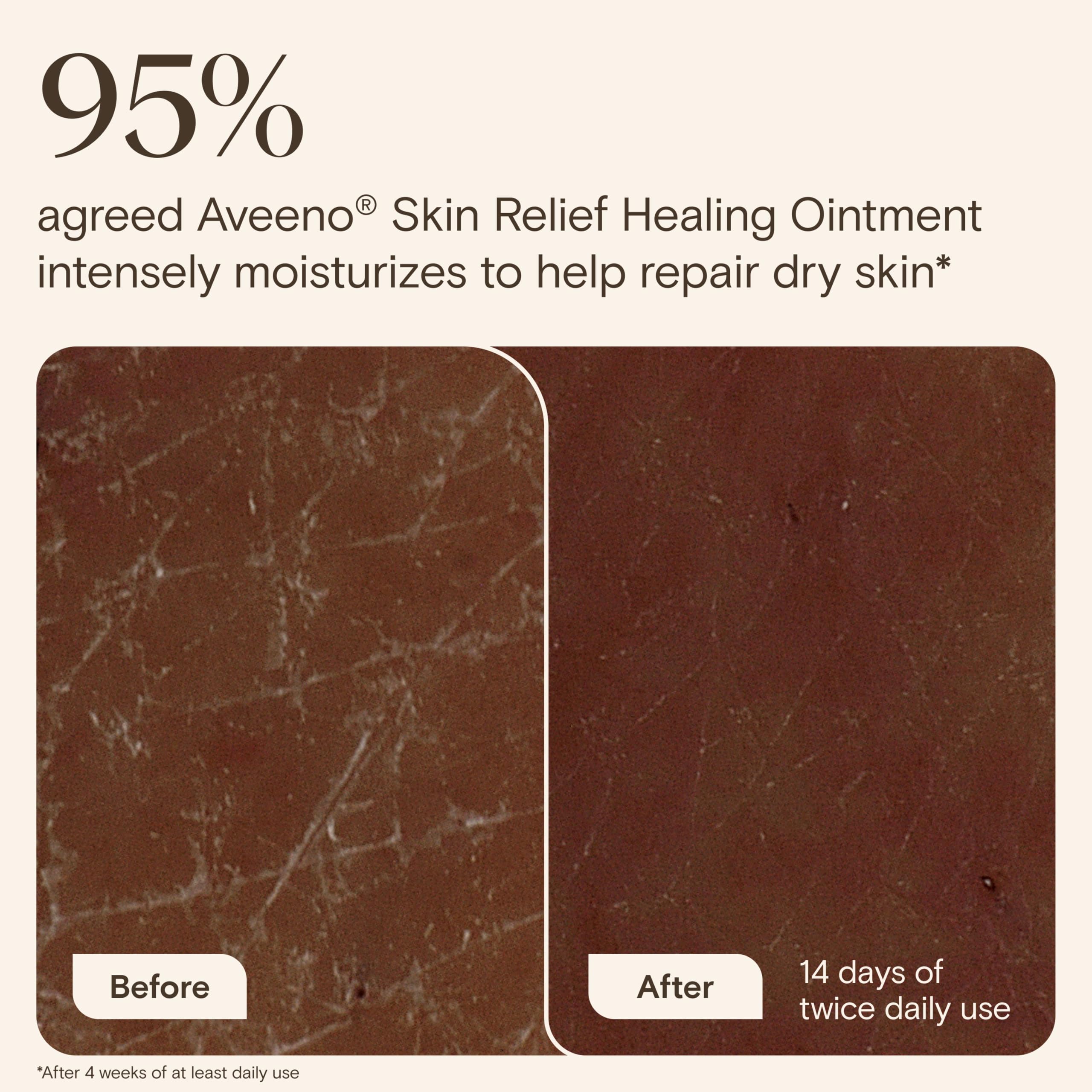 Detalle de textura del ungüento Aveeno que evidencia absorción rápida