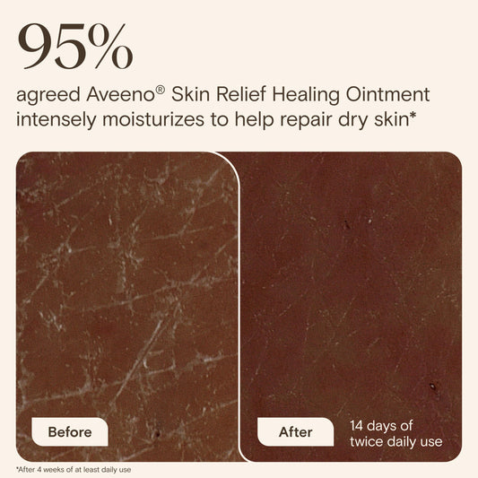 Detalle de textura del ungüento Aveeno que evidencia absorción rápida