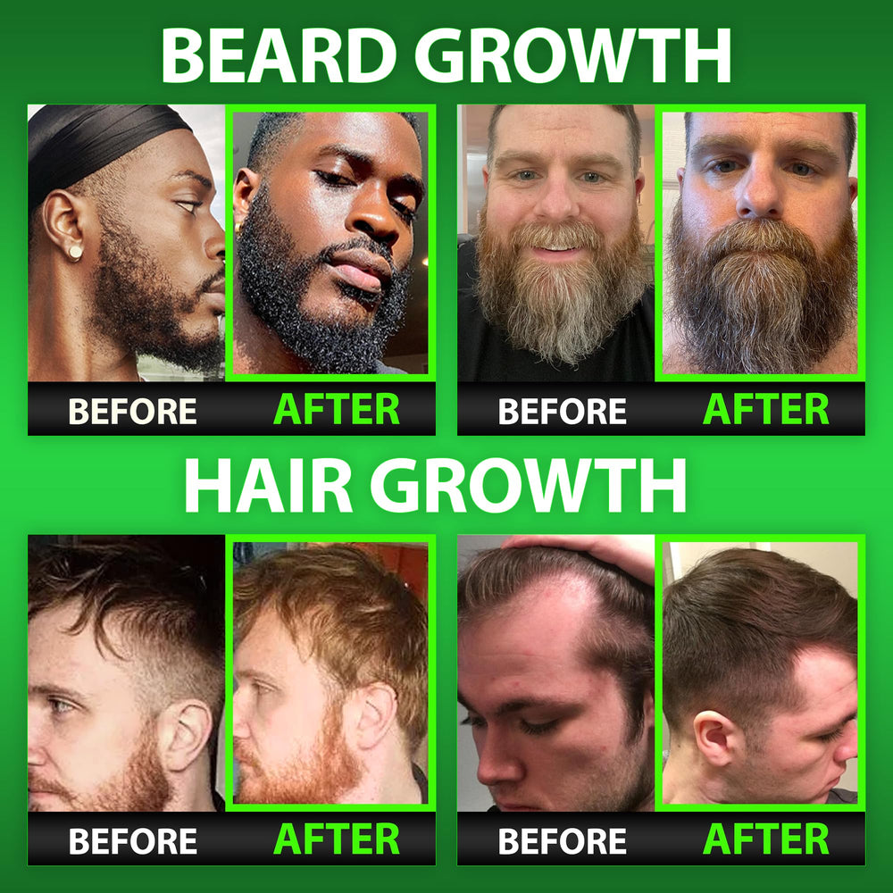 BBS BEST BEARD STUFF gomitas masticables en primer plano con aspecto apetecible