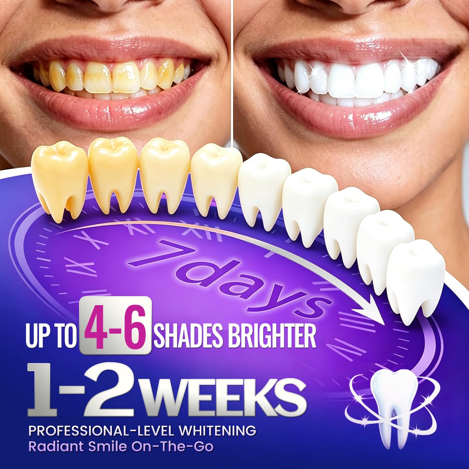 Comparación de tonos dental junto a tiras BeauQuay que ilustra posible aclarado