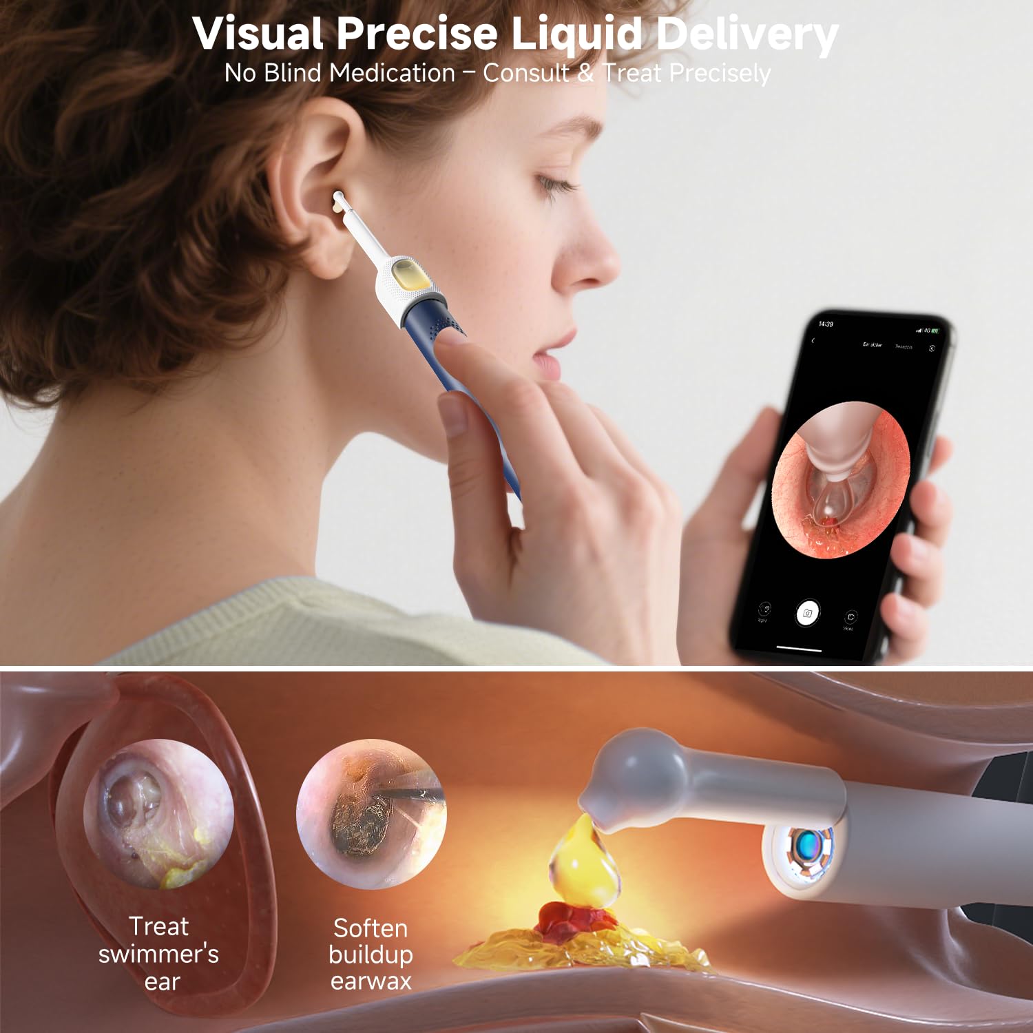 BEBIRD R1 Ultra pinzas otoscópicas, extracción delicada y sin daño