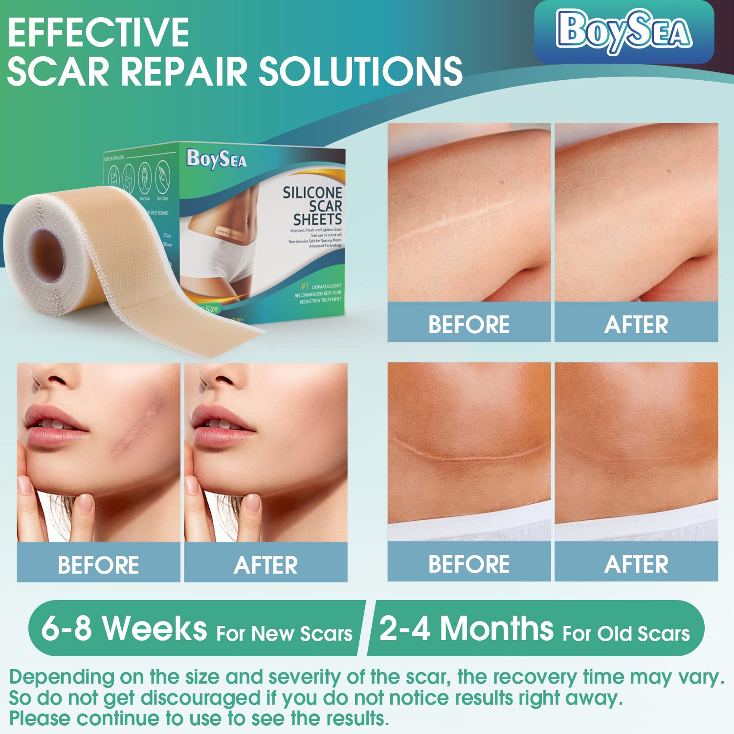 Boysea detalle del borde flexible de la lámina, se adapta a contornos