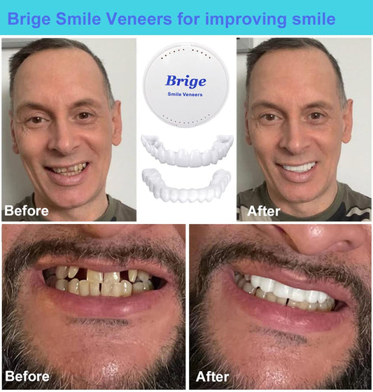 Brige primer plano textura y forma de los dientes, acabado natural