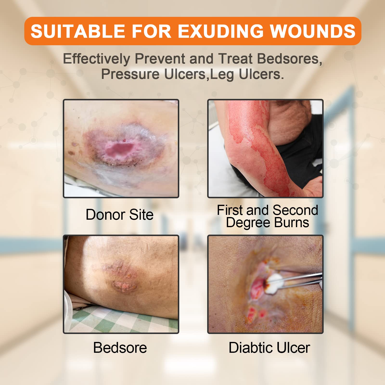 CARBOU capa de silicona cercana reduce dolor en extracción
