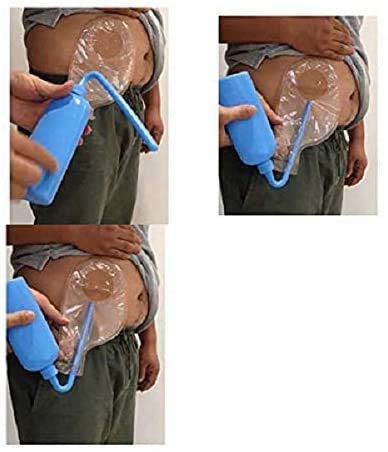 CLCМS material flexible fácil de apretar para un flujo controlado