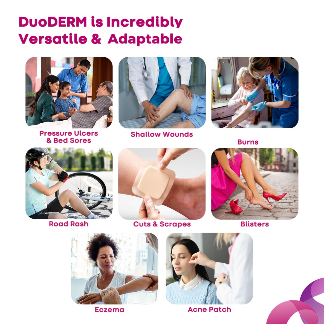 ConvaTec DuoDERM borde flexible detalle que facilita adaptación a contornos