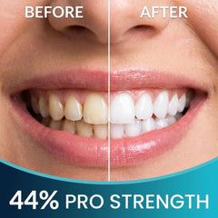 Cool Teeth Whitening aplicación en boca con bandeja y gel para uso práctico