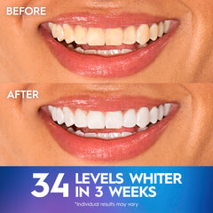 crest tiras aplicadas en dientes demostrando uso cómodo diario