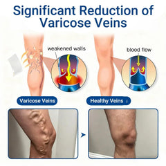 cxuhui Vein Ease parche aplicado en la pierna, aporta comodidad y discreción