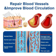 cxuhui Vein Ease etiqueta de ingredientes naturales, transparencia y seguridad