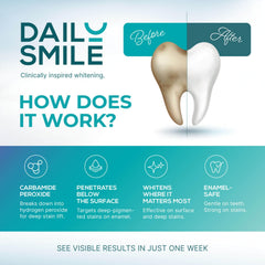 DailySmile pluma abierta con gel visible para aplicación controlada