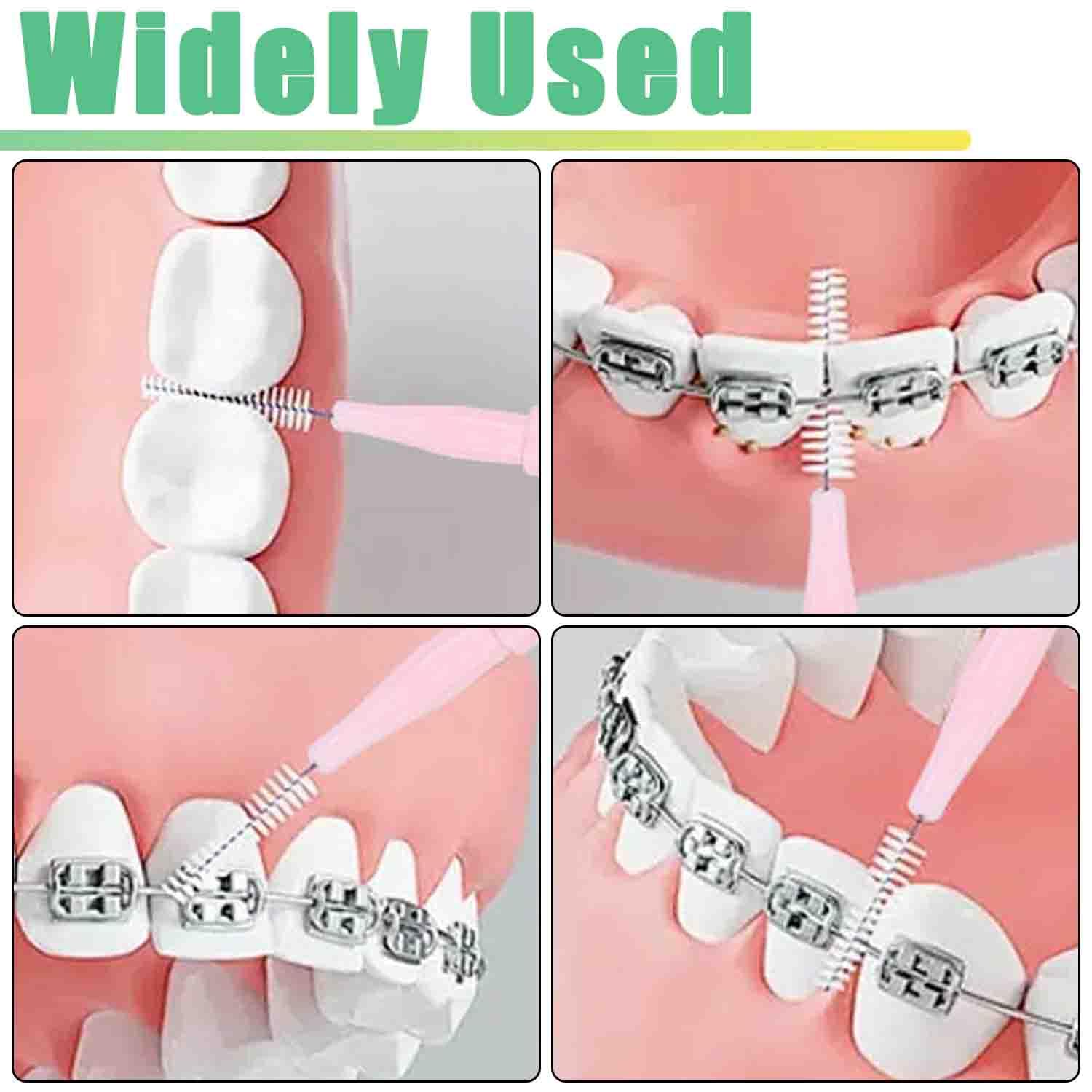 DHYLRICHER cepillo en uso entre dientes para eliminar restos alimenticios