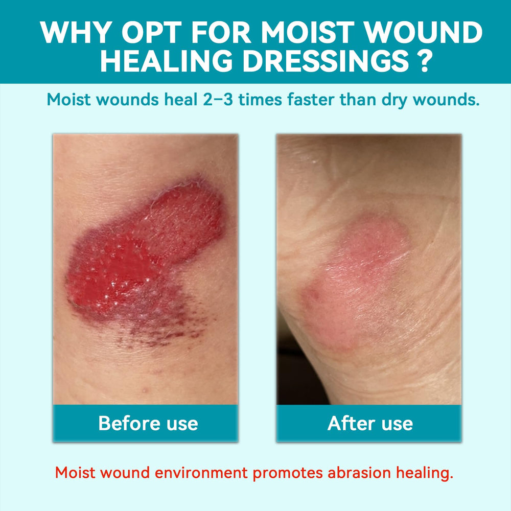 Comparación de tamaño Dimora en la palma de una mano para evaluar cobertura precisa