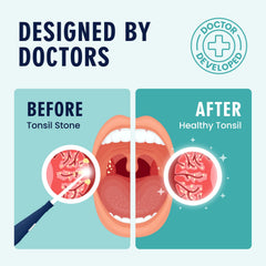 Dr. Frederick's irrigador oral detalle del flujo para limpieza precisa