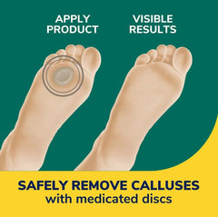 Dr. Scholl's almohadilla dentro de zapato cotidiano alivia presión