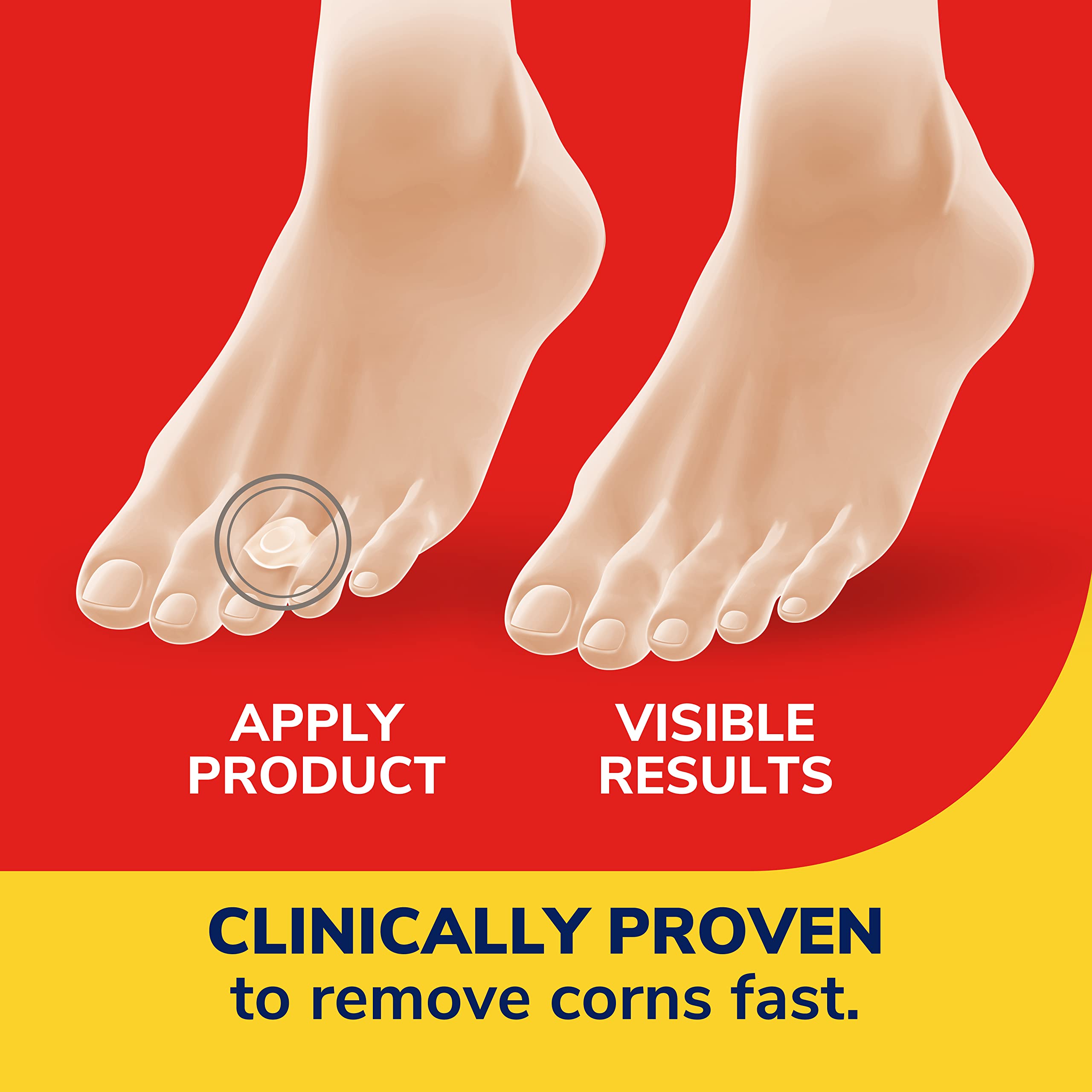 Dr. Scholl's parche colocado en el pie dentro de zapato para confort diario