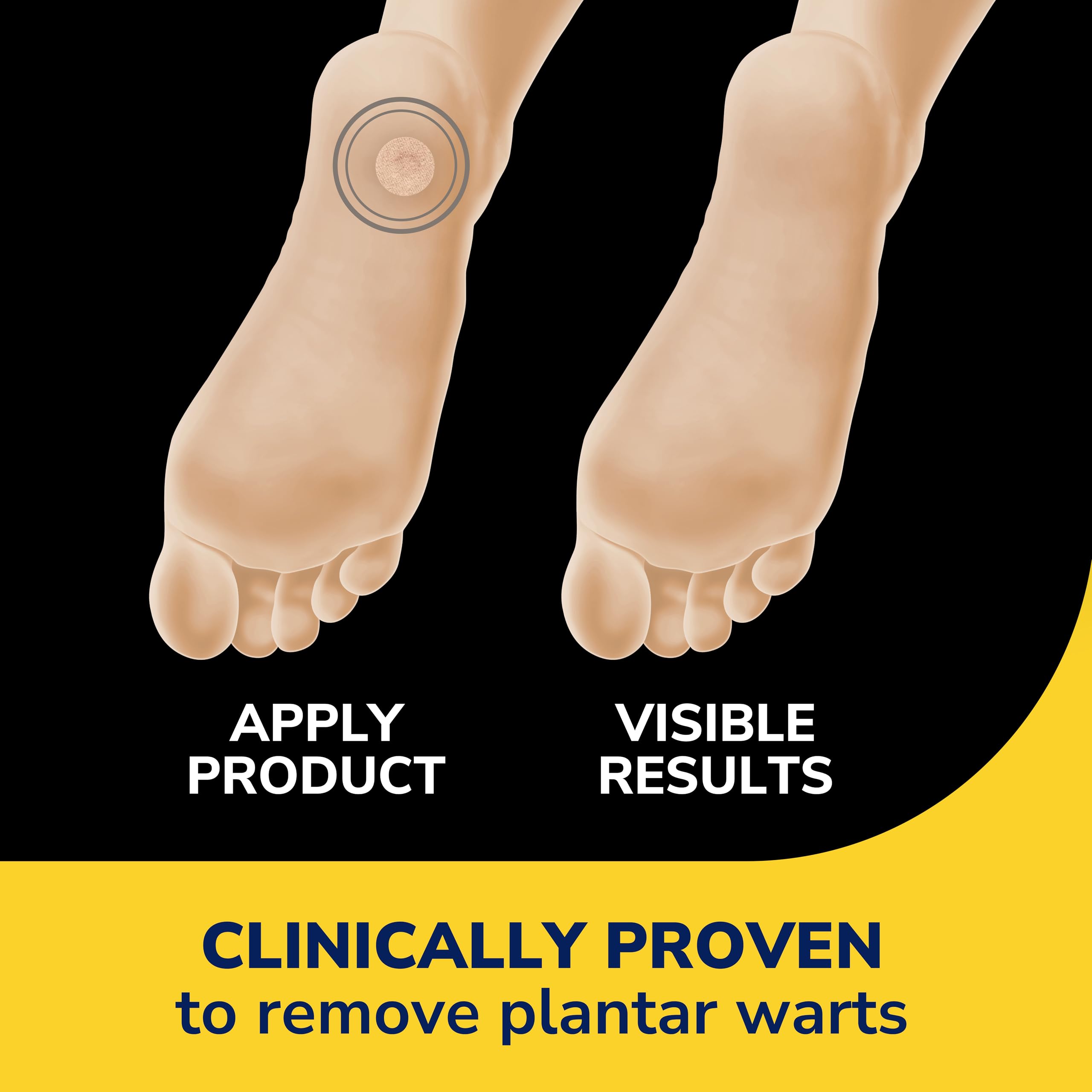 Dr. Scholl's parche aplicado en la planta del pie ofreciendo protección al caminar