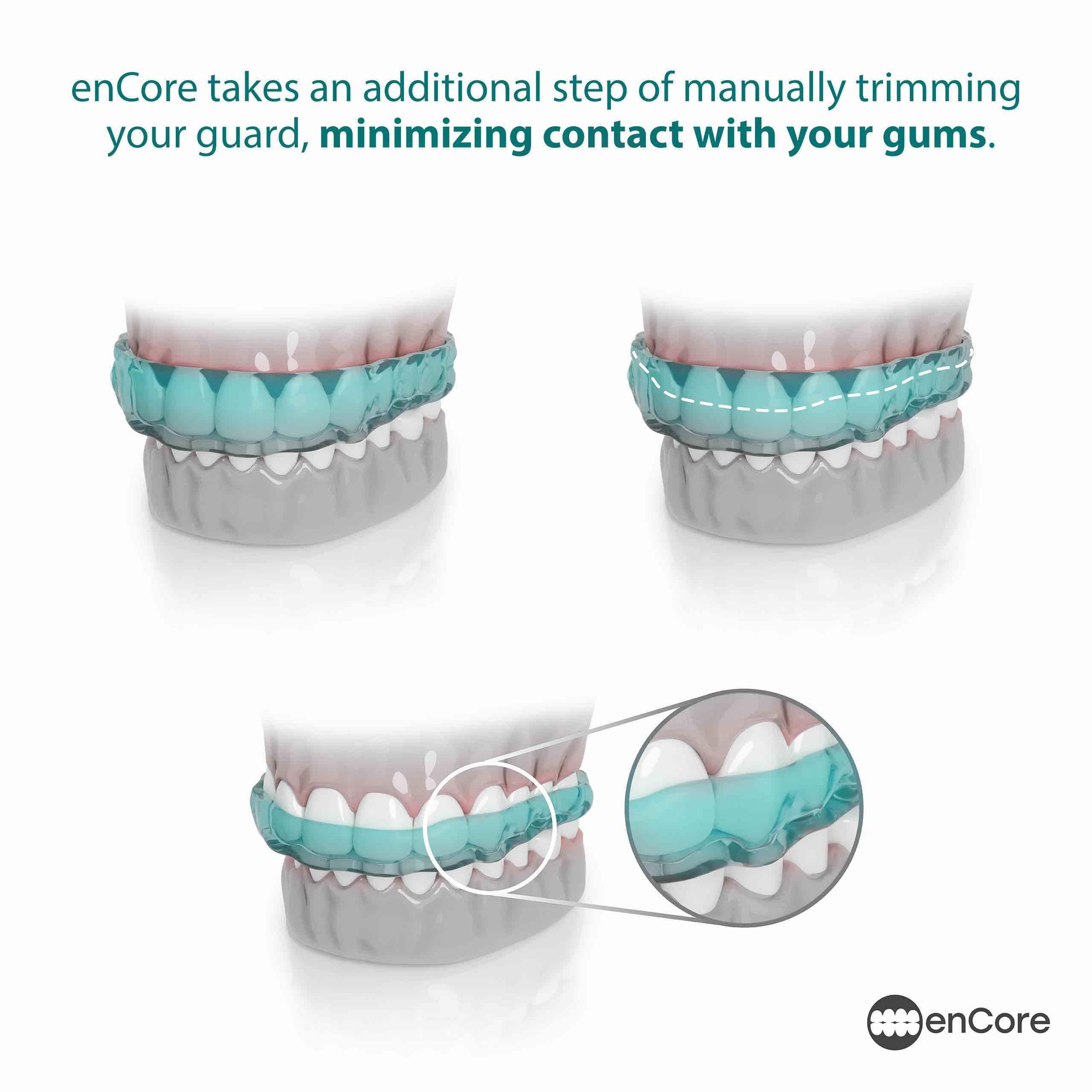 enCore kit de impresión casera con todas las piezas para molde dental