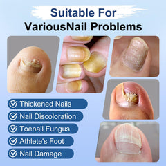 ERWCNMIE textura del líquido antifúngico, absorción rápida visible